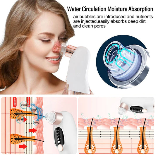 Electric Blackhead Remover Skin Tag Remover Deep Dirt Skin Cleaning Machine with 6 Suction Heads Adjustable Gear Beauty Device